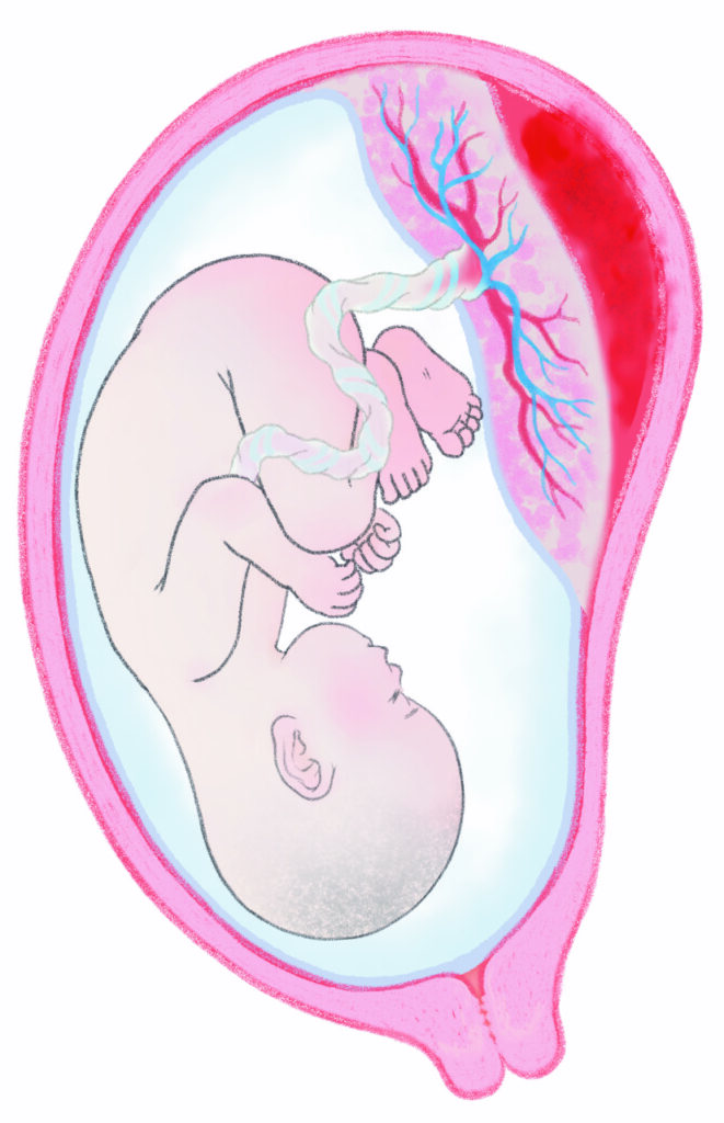 胎盤と臍の緒で繋がった胎児が羊水の中で浮かんでいる