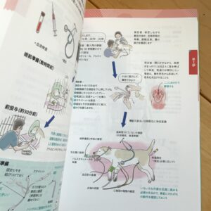 気管チューブの挿管の手技を解説したイラスト