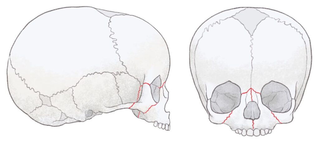 小児の頭蓋骨と成長