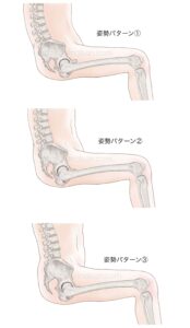 椅子に座った人体と背骨と骨盤の傾き