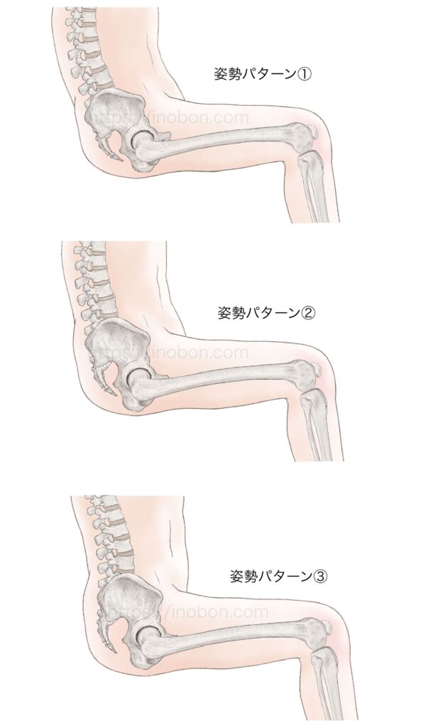 椅子に座った人体と背骨と骨盤の傾き
