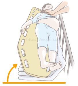 妊婦の心肺蘇生