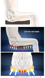 尾骨と坐骨結節部の骨、座位の人体イラストと褥瘡予防クッション