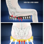 尾骨と坐骨結節部の骨、座位の人体イラストと褥瘡予防クッション