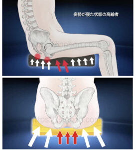 尾骨と坐骨結節部の骨、座位の人体イラストと褥瘡予防クッション
