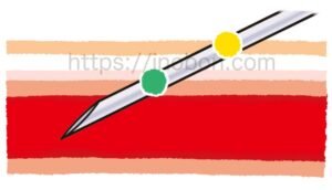 採血針の位置、血管壁と皮膚の断面の図