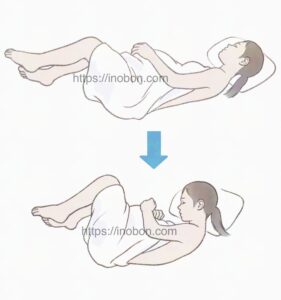 横向きにねる女性患者、脊椎麻酔、腰椎麻酔と体位