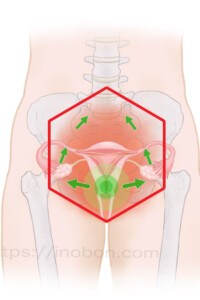 子宮内の放射線照射