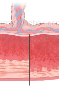 胎盤の癒着の進行を表した図