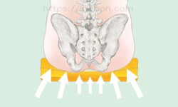 骨盤のイラスト、座位、褥瘡予防のポジショニング、仙骨部、尾骨部