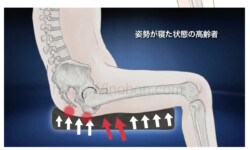 尾骨と坐骨結節部の骨、座位の人体イラストと褥瘡予防クッション