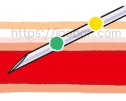 採血針の位置、血管壁と皮膚の断面の図
