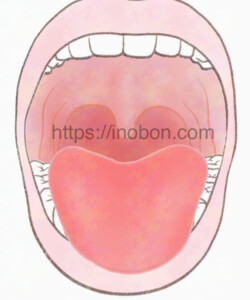 2024年メディカ出版 『舌の根本が奥に落ち込んでいない様子』 大きく開いた口、口腔内と舌の位置